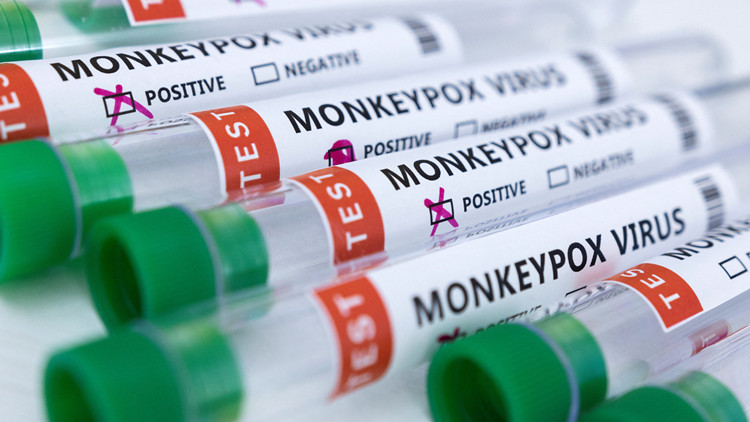 英國報告猴痘確診病例超500例