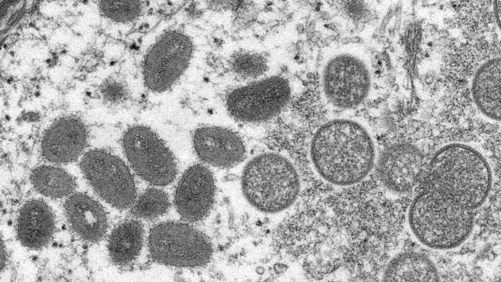 世衛組織：將再探討是否列猴痘為全球衛生緊急事件