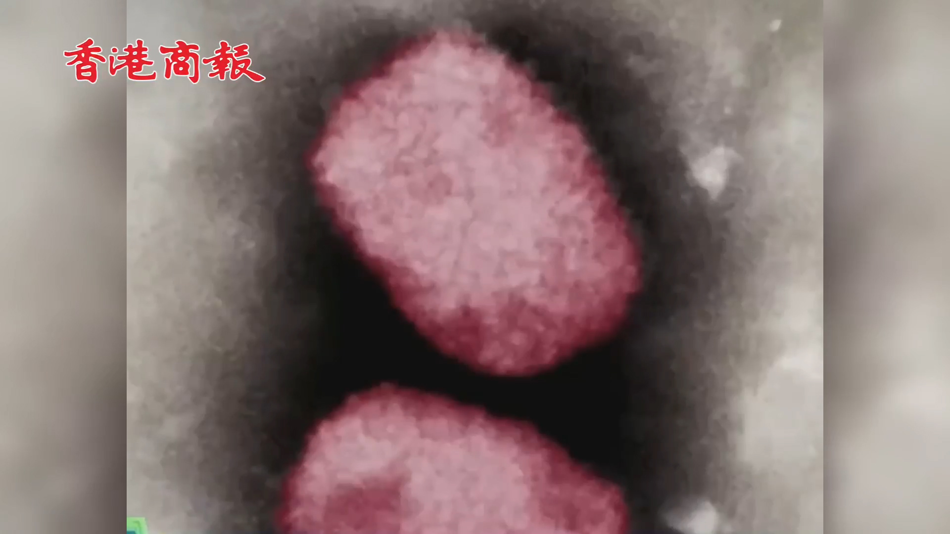 有片 | 香港現首宗猴痘輸入！！港府：已有預案防猴痘爆發 預防病毒一定做好這四點