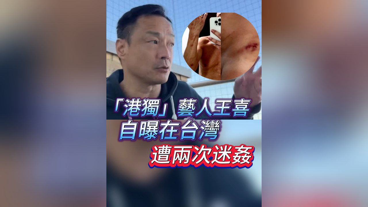 有片｜「港獨」藝人王喜自曝在台灣遭兩次迷姦