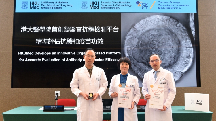 港大醫學院首創類器官抗體檢測平台 精準評估抗體和疫苗功效 助FDA加快類器官技術應用