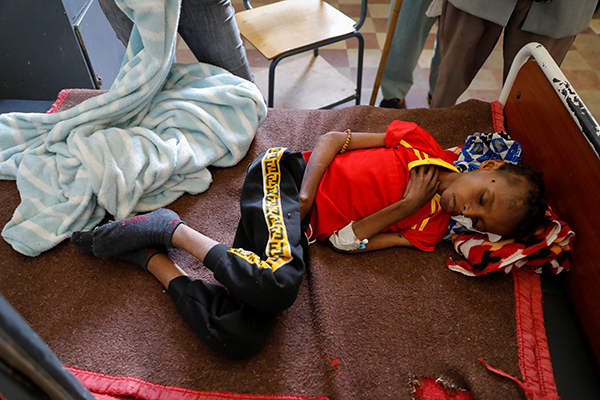 埃塞俄比亞陷戰亂 550萬人處於饑荒