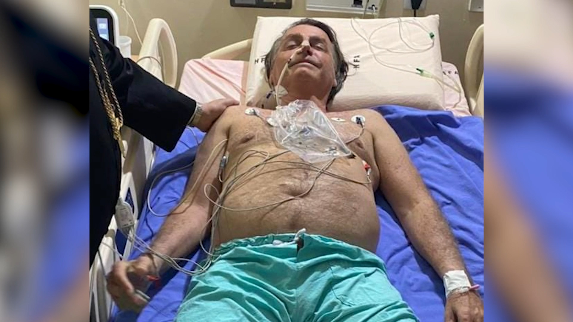 有片丨連續打嗝10天 巴西總統博索納羅入院檢查