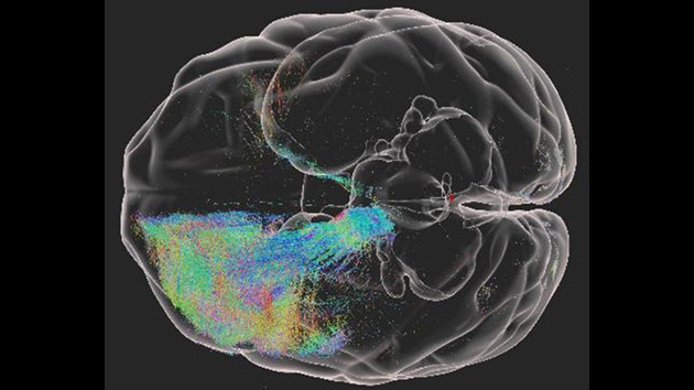 中國科學家實現迄今最高精度獼猴大腦三維高清成像