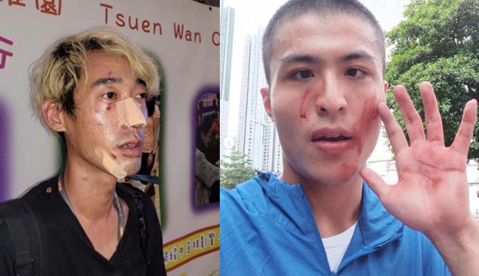 「劉馬車」襲擊網台記者自首 涉傷人被捕