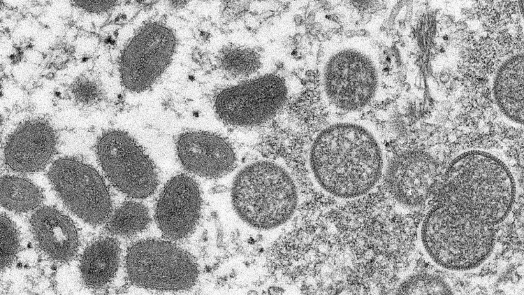 內地11月新增80例猴痘病例