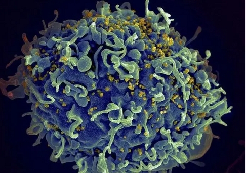 全球第七名艾滋病治癒患者被確認